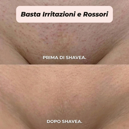 Rasoir 2 en 1 pour bikini et corps Modovita™