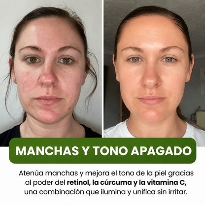 Mascarilla Facial Coreana con Cúrcuma y Colágeno