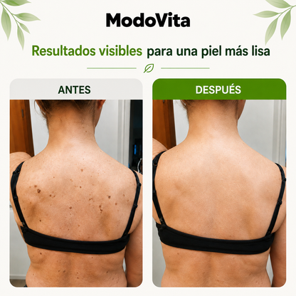 Modovita – Barra Exfoliante con Ácido Glicólico