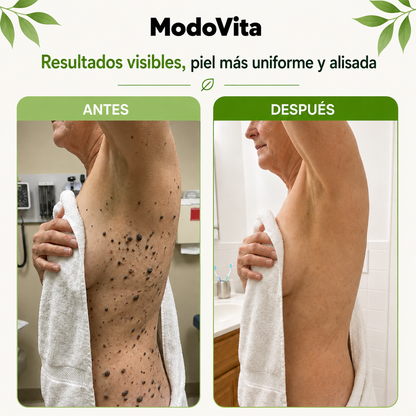 Modovita – Barra Exfoliante con Ácido Glicólico
