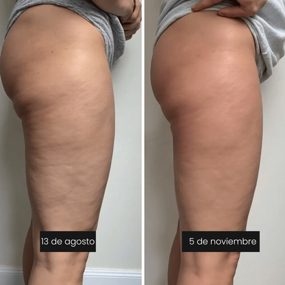 CelluFit™ – Leggings 3D Anticelulíticos y Moldeadores